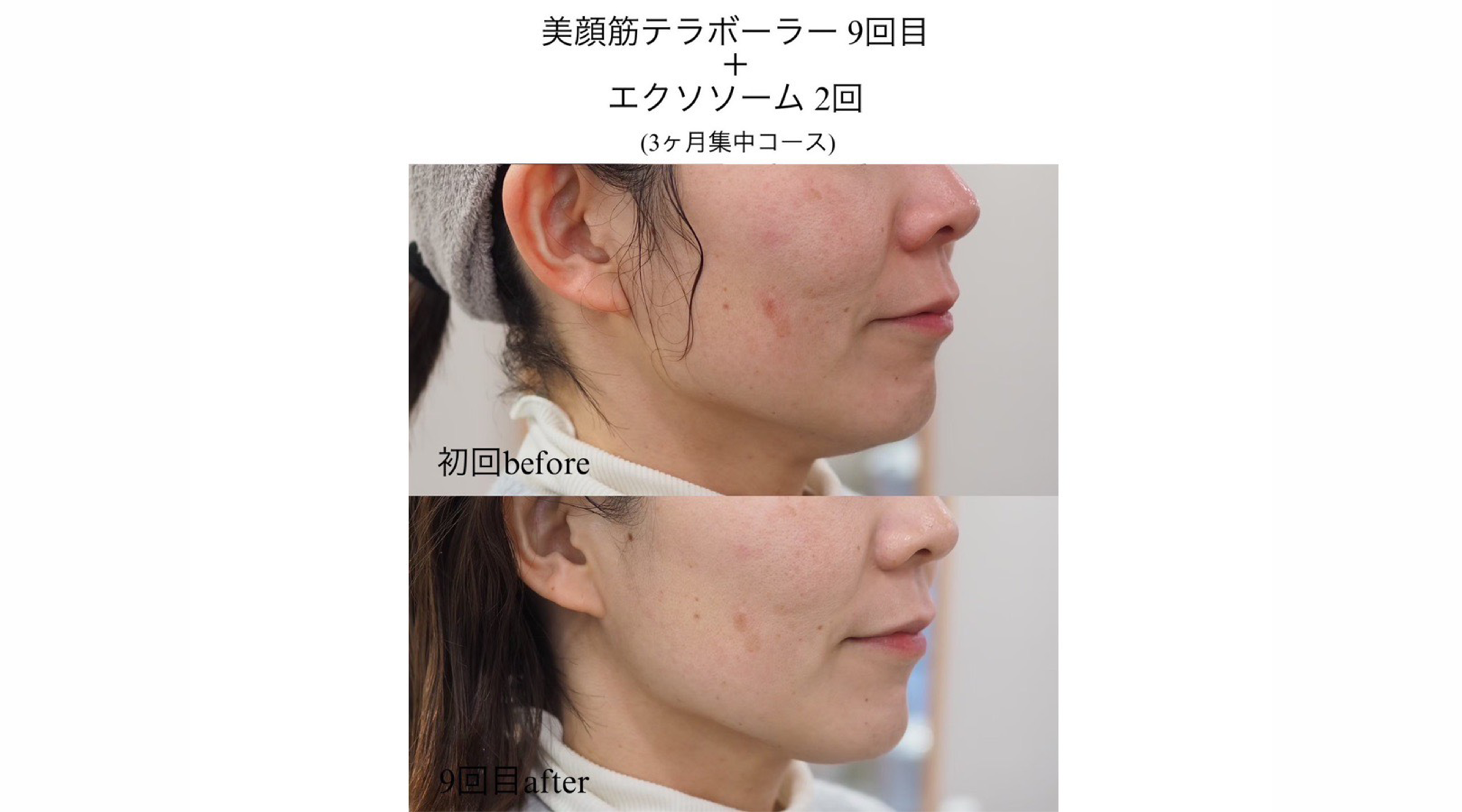 BeatySalonTCM-y…のサブ写真２